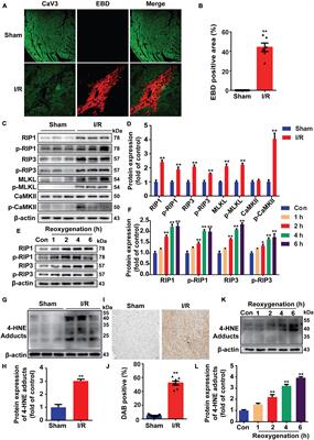 4-Hydroxy-2-Nonenal Promotes Cardiomyocyte Necroptosis via Stabilizing Receptor-Interacting Serine/Threonine-Protein Kinase 1